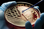 Antibiotic resistance