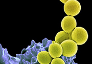 Superbugs